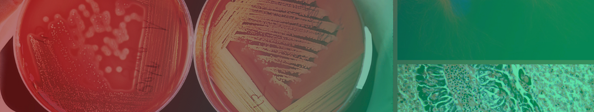 BannerMTCL